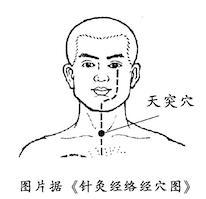 頸椎病的米字操？米字操頸椎保健操！